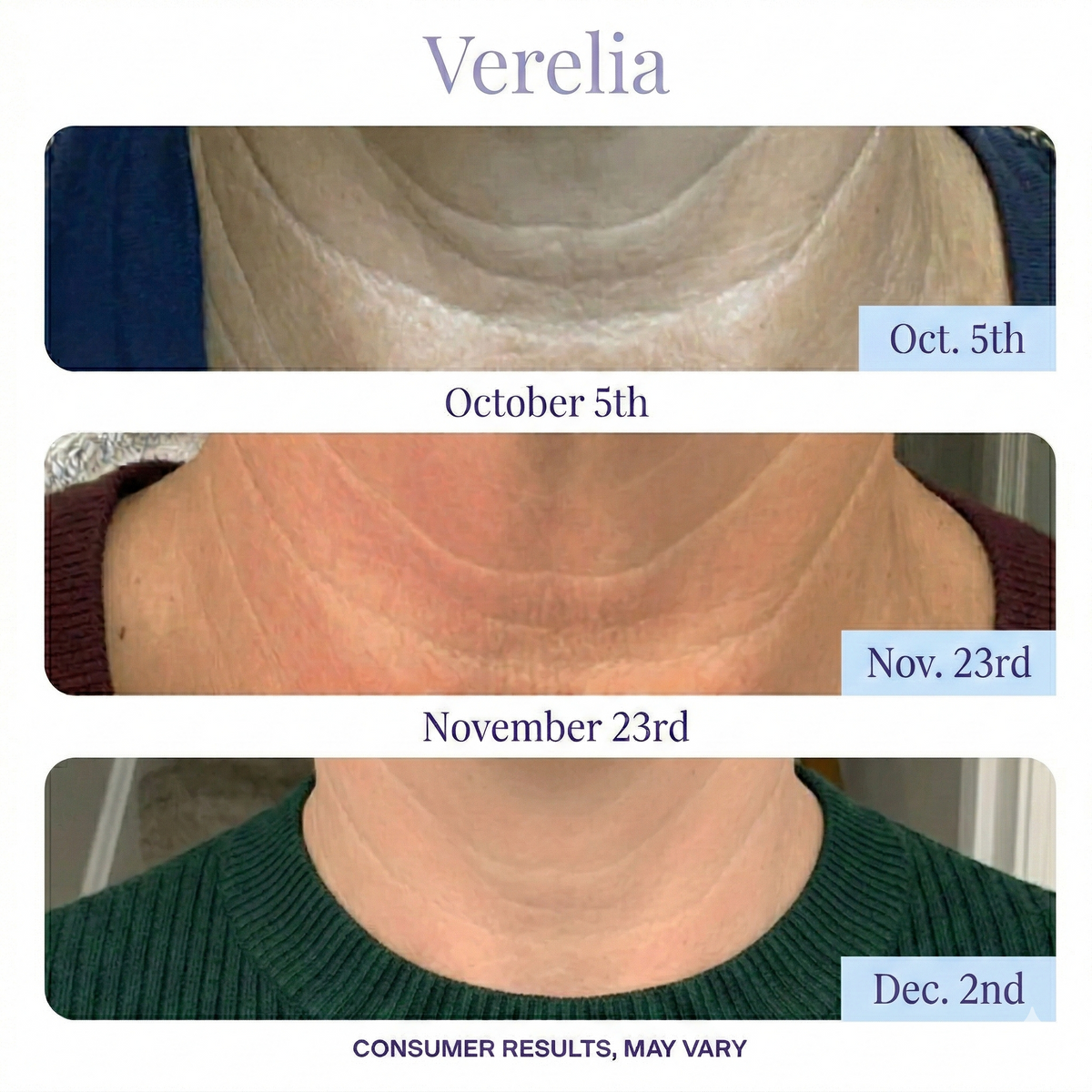 Youth-Guard™ Ultimate Neck Lift Cream